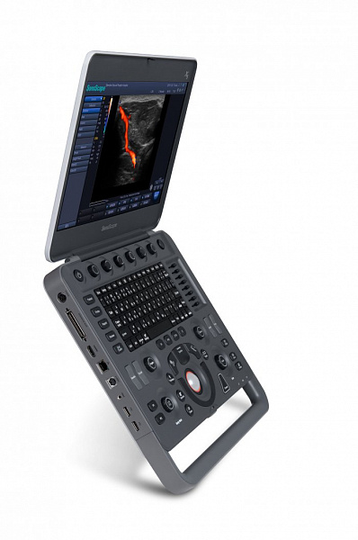 Портативная ультразвуковая система Sonoscape S2N