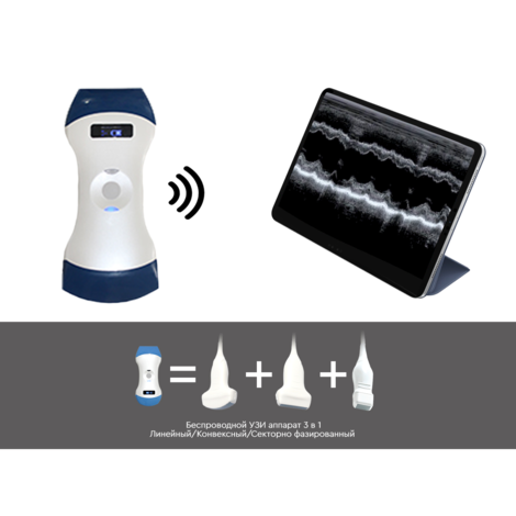 Беспроводной УЗИ аппарат ELS-MED-MINI