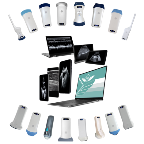 Беспроводной УЗИ аппарат ELS-MED-MINI