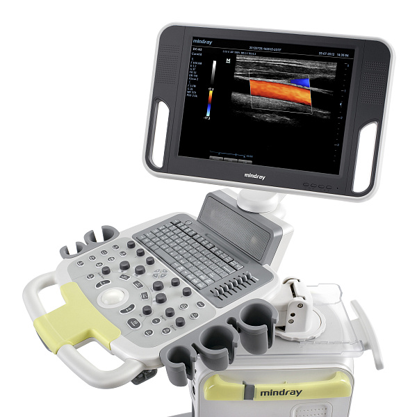 УЗИ-аппарат Mindray DC-N3