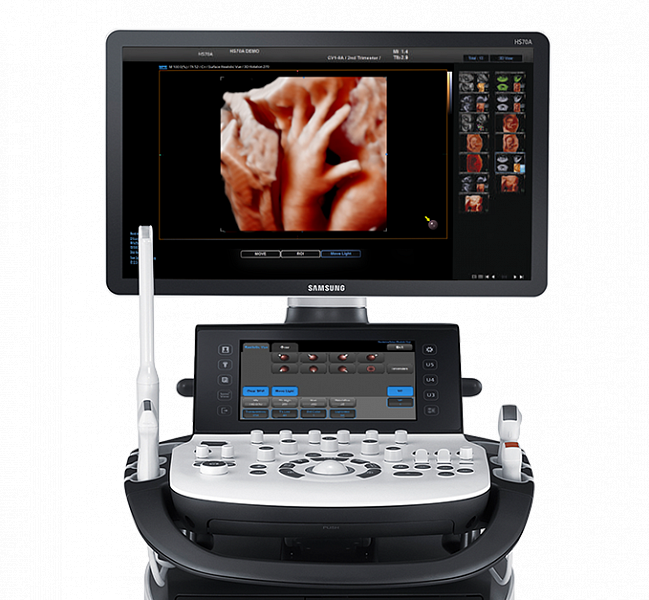 Экран аппарата узи. Samsung medison hs70. medison hs 70a. samsung узи hs 70.