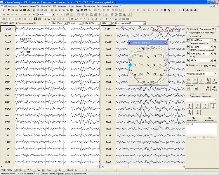 Электроэнцефалограф Нейрософт модель Нейрон-Спектр-1