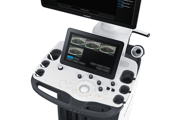 Ультразвуковой сканер Samsung модель RS80